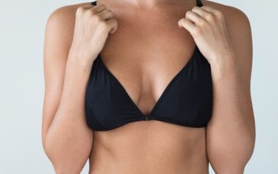 ¿Cómo conseguir que una mamoplastia o aumento de pecho se vea natural?