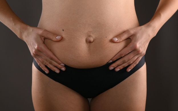 Diástasis abdominal: Síntomas y tratamientos