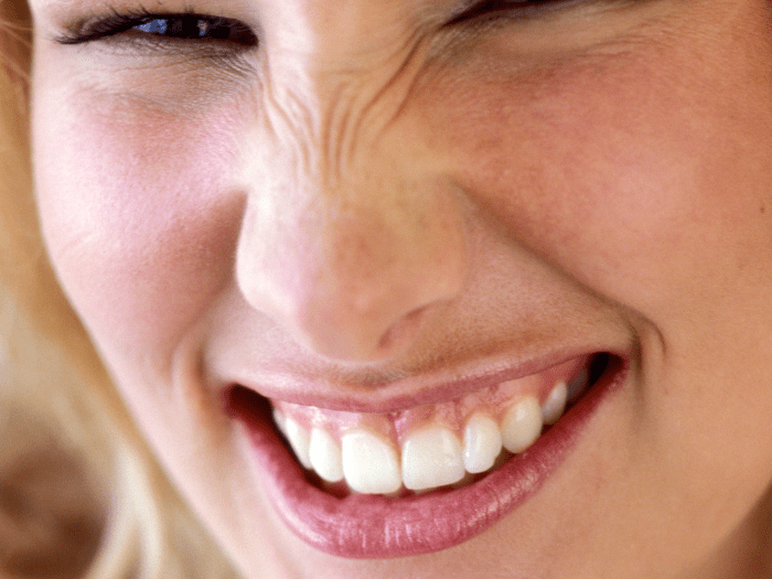 6 Aspectos de la nariz que podemos corregir en una rinoplastia