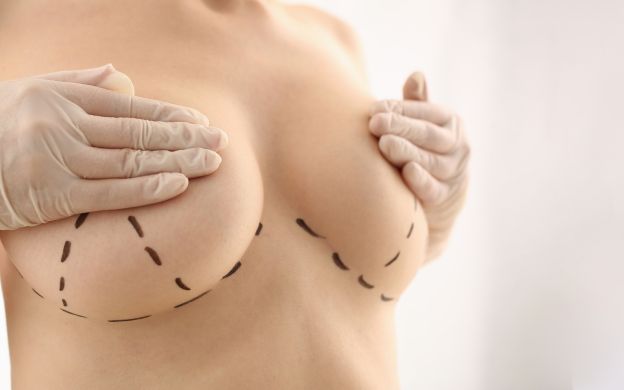 5 preguntas y respuestas comunes sobre las mamas tuberosas