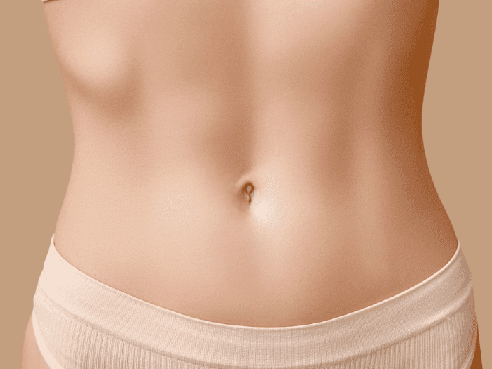 ¿Se quedará plano el abdomen tras una liposucción?
